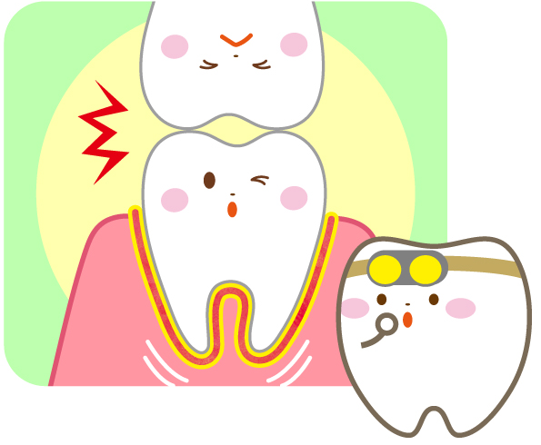 歯根膜には強い力がかかっている